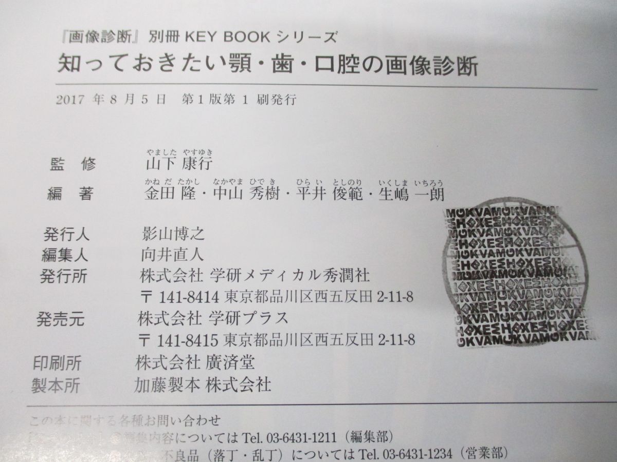 ▲01)【同梱不可】知っておきたい顎・歯・口腔の画像診断/画像診断別冊/山下康行/学研メディカル秀潤社/2017年発行/A_画像6