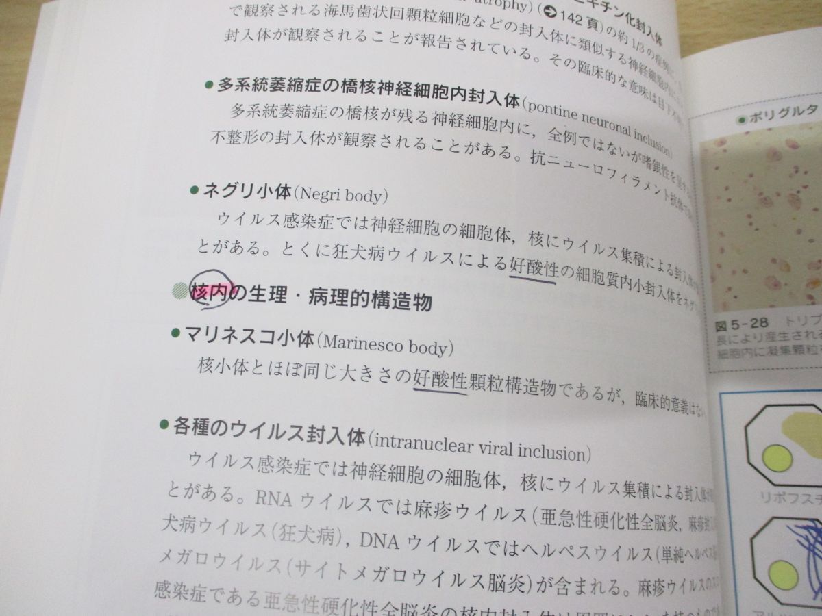 ●01)【同梱不可】神経病理インデックス/新井信隆/医学書院/2005年発行/A_画像4