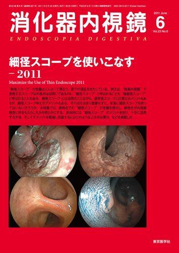 [A01259629]消化器内視鏡第23巻6号　細径スコープを使いこなす―2011 (消化器内視鏡2011年6月号) 消化器内視鏡編集委員会_画像1