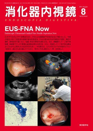 [A11083534]消化器内視鏡第23巻8号　EUS-FNA Now (消化器内視鏡2011年8月号) 消化器内視鏡編集委員会_画像1