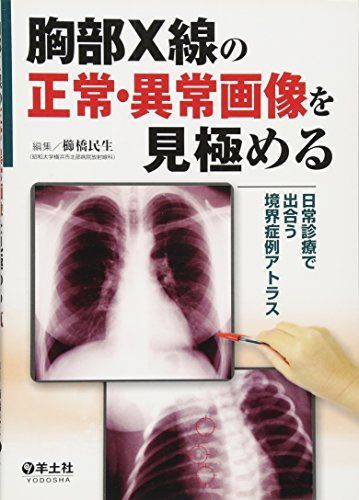 [A12201289]胸部X線の正常・異常画像を見極める―日常で出合う境界症例アトラス [単行本] 民生，櫛橋_画像1