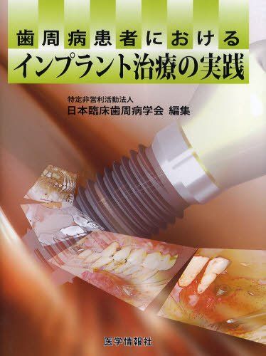 [A12113790]歯周病患者におけるインプラント治療の実践 日本臨床歯周病学会_画像1