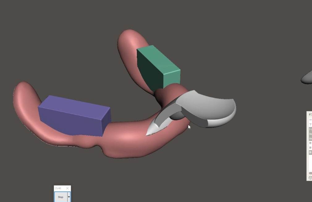 歯科　歯科技工　デジタル個人トレー作成手順説明動画　mp4 　meshmixer cad cam デジタルデンタルデザイン_画像5