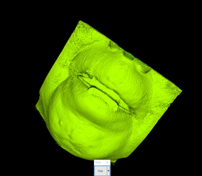 歯科 歯科技工 ダイコムデータから骨や歯のデータを抜き出す手順動画 mp4 CBCT の画像3