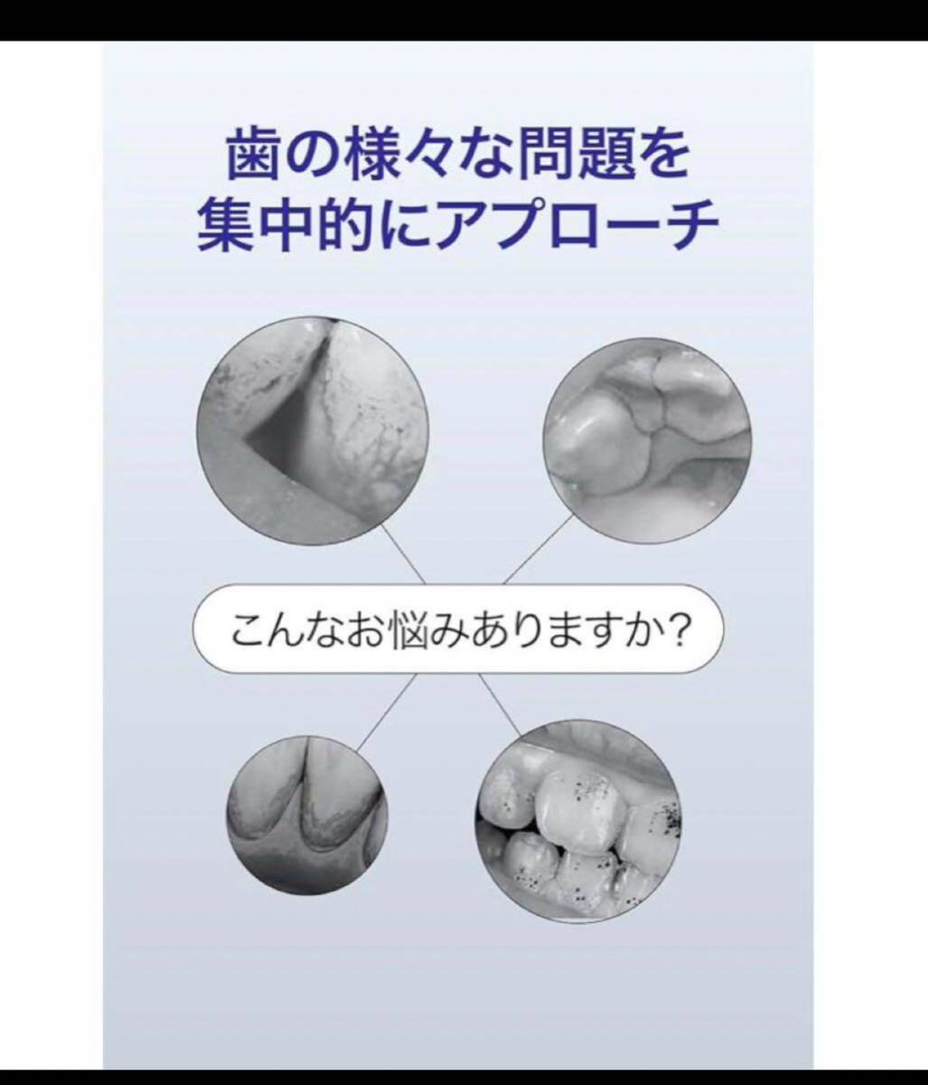 SIWING 超音波歯間クリーナー 歯 クリーナー 口腔洗浄器 家庭用歯清潔器 USB 充電式 携帯用歯清潔器 クリーニング 高周波振動 IPX6防水_画像5