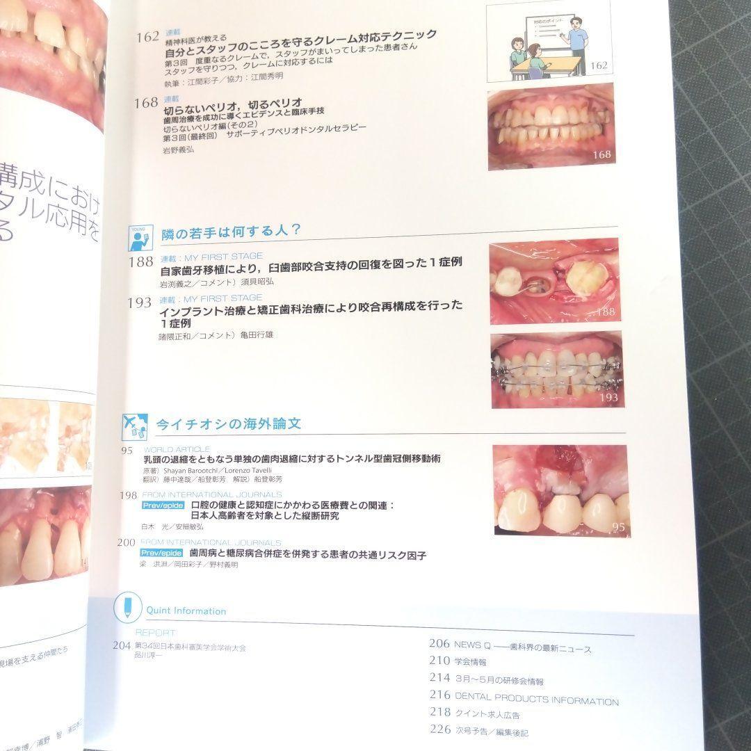 クインテッセンス　2024年3月号　 健全な永久歯列完成のために、 このとき、ここを診る、これをやる（前編）_画像4