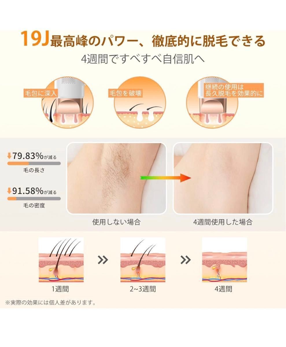 YUNDOO 脱毛器 レディース vio対応【2024 最新サロン級IPL脱毛器 YUNDOO 脱毛器 レディース vio対応【2024 最新サロン級IPL脱毛器