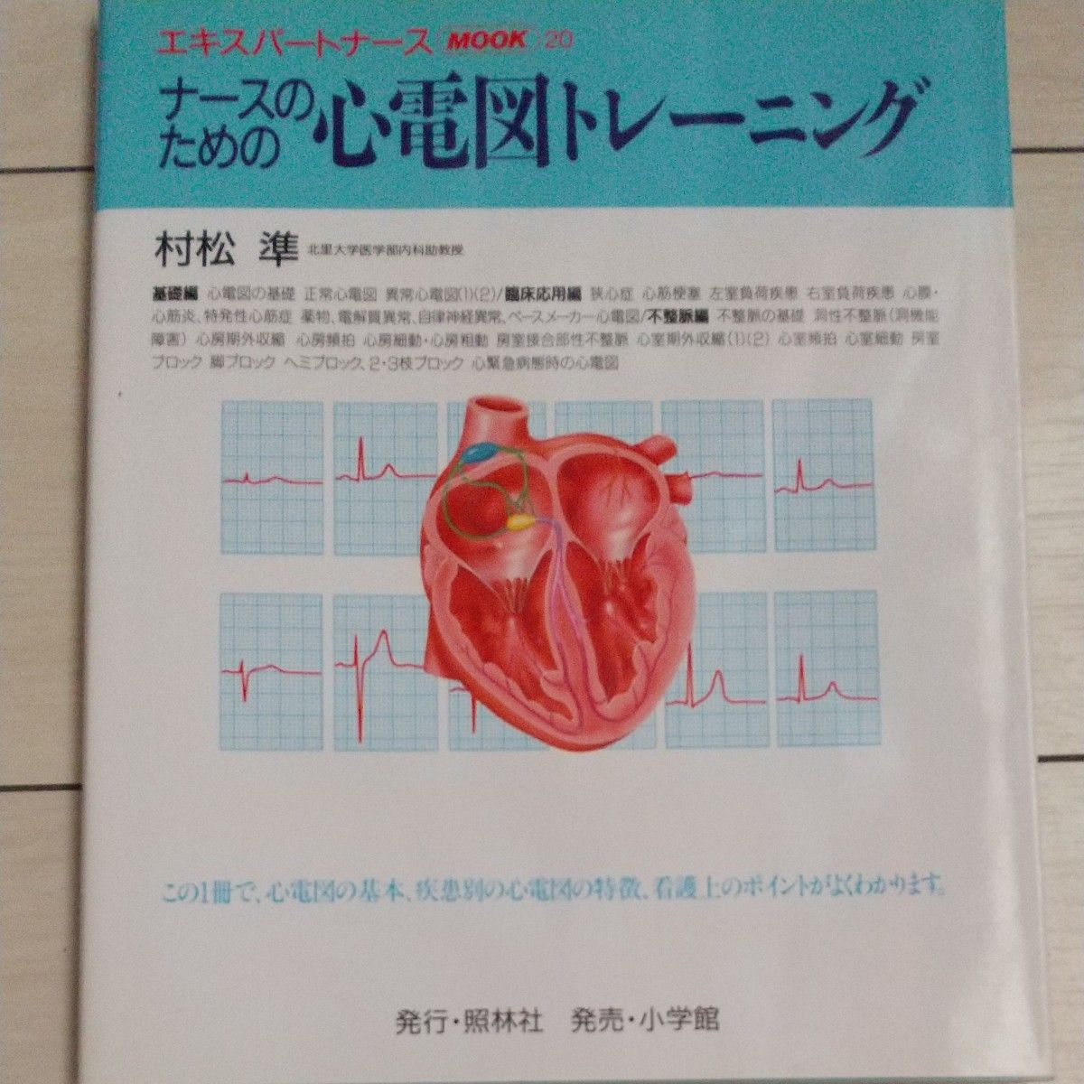 ナースのための心電図トレーニング エキスパートナースＭＯＯＫ２０／村松準 (著者)