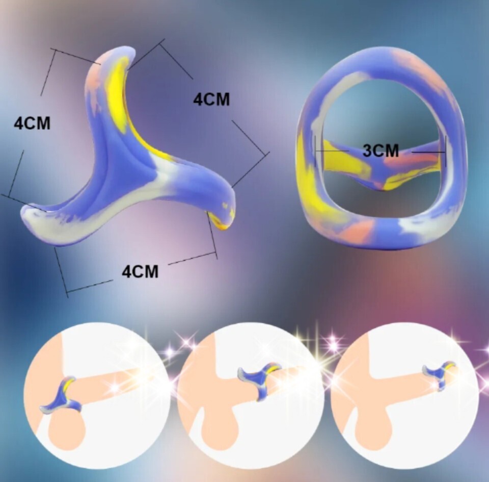 カチンコチン変身！ペニスリング シリコン コックロックリング 遅延 矯正 男性 包茎 皮 拡大 延伸　y20_画像4