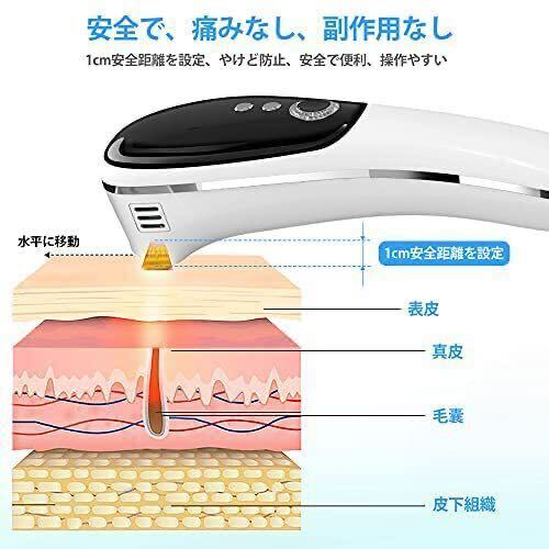 脱毛器レーザー IPL光脱毛器 永久脱毛 家庭用5段階調整 99万回照射 連続フラッシュ 痛み無く 男女兼用 全身脱毛 PSE認証日本語説明書