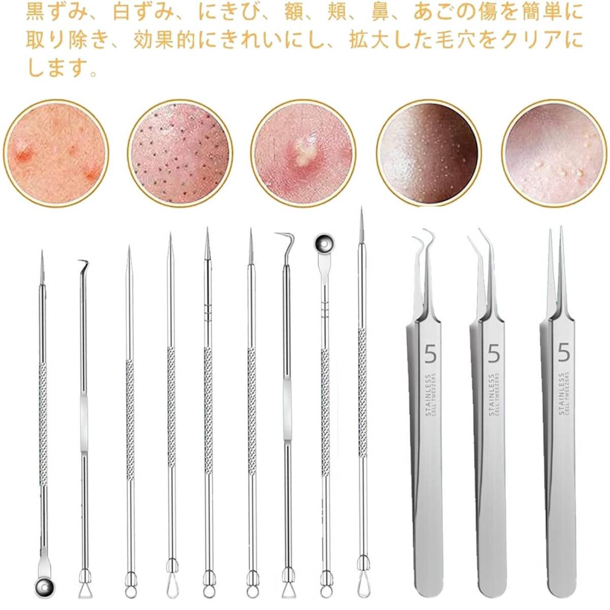 【在庫セール】毛穴ケア専用キット 先端は幅0.1mm 黒ずみ取り ニキビ取り ニキビ針 【専用12本セット】 ピンセット 稗粒腫 _画像4