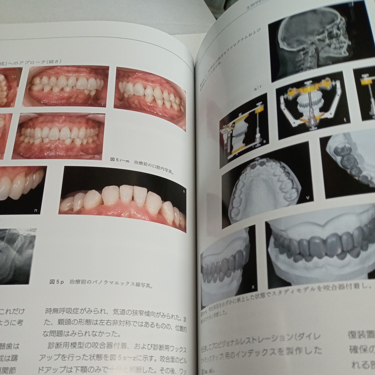 歯科 歯科技工 本 QDT 2024年4月号 最新号の画像3