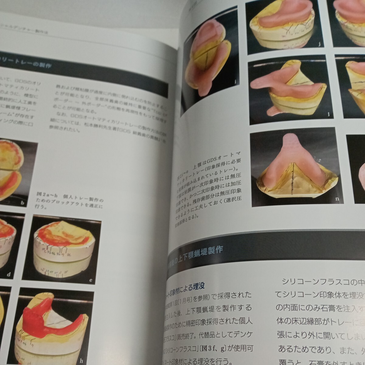 歯科 歯科技工 本 QDT 2024年4月号 最新号の画像4