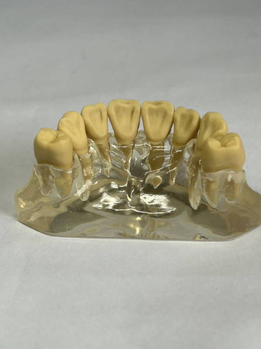 ネイチャーズ・モルフォロジー　歯牙形態の増齢変化　　　若年代・中年代・老年代の歯牙形態モデル　希少　歯科　歯科技工_画像7