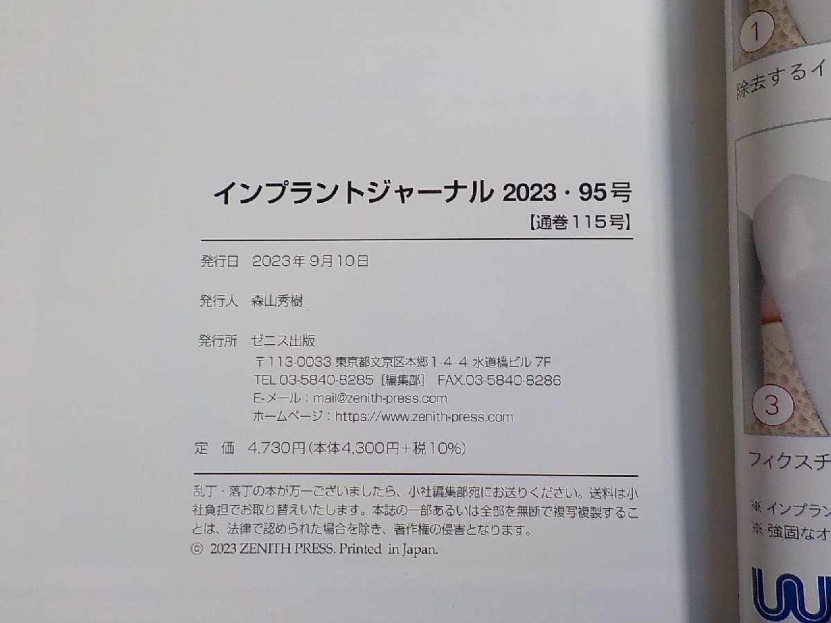 8K0070◆インプラントジャーナル 2023・95号 (通巻115号) ゼニス出版(ク）の画像3