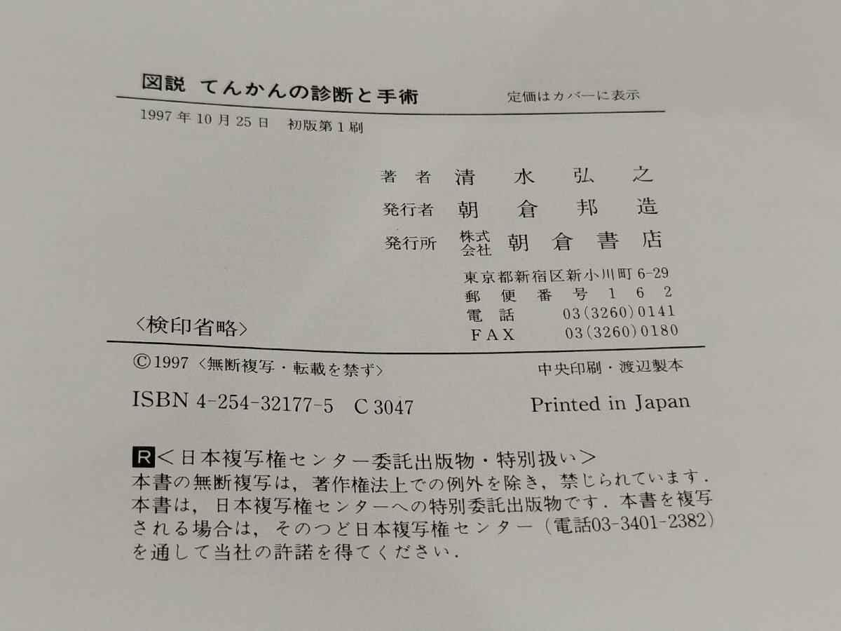 図説 てんかんの診断と手術　清水弘之　朝倉書店【ac04f】_画像6