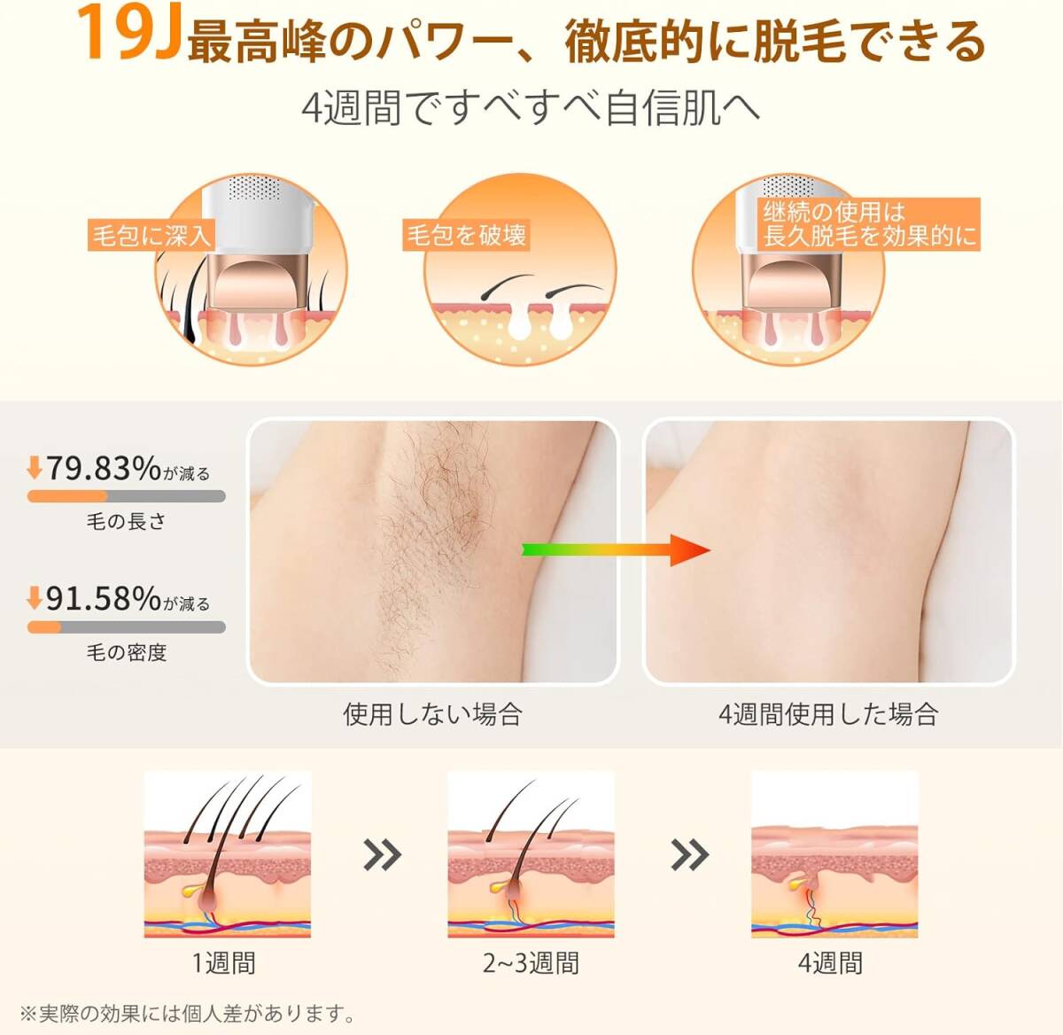 200 脱毛器 レディース vio対応【2024 最新サロン級IPL脱毛器】メンズ 光美容器 99万発 高出力19.3J 家庭用脱毛器 大画面タッチパネル搭載_画像2