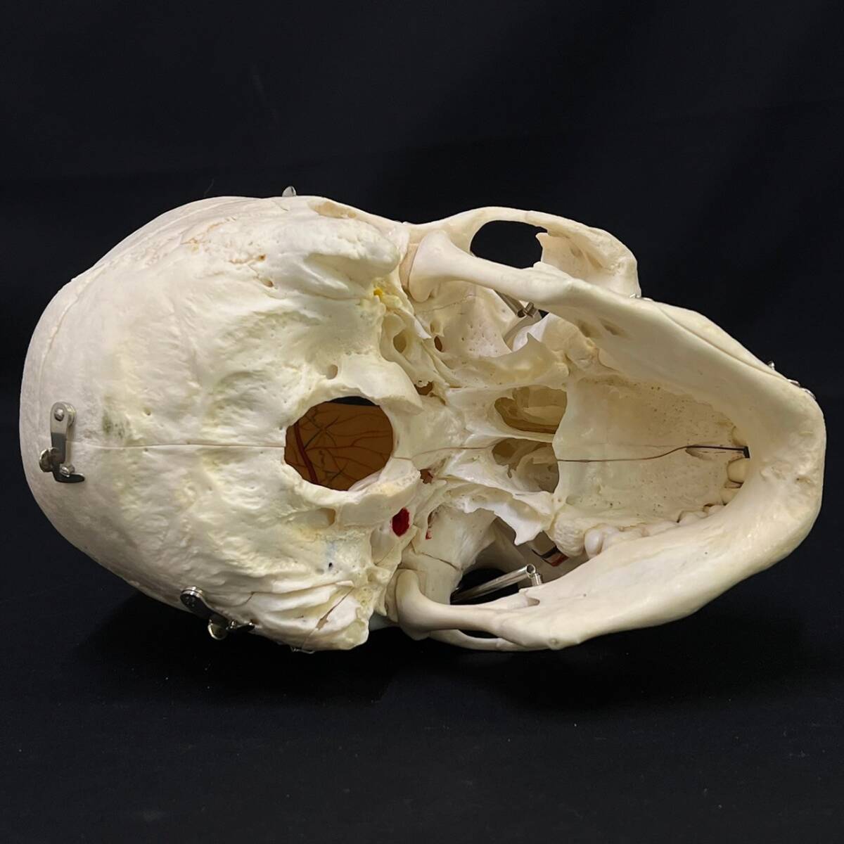 BDg158R 80 頭蓋骨 模型 分解模型 標本 医学 医療 資料 歯科 クリアケース付 骸骨 ガイコツ スカル デッサン アンティーク 美術