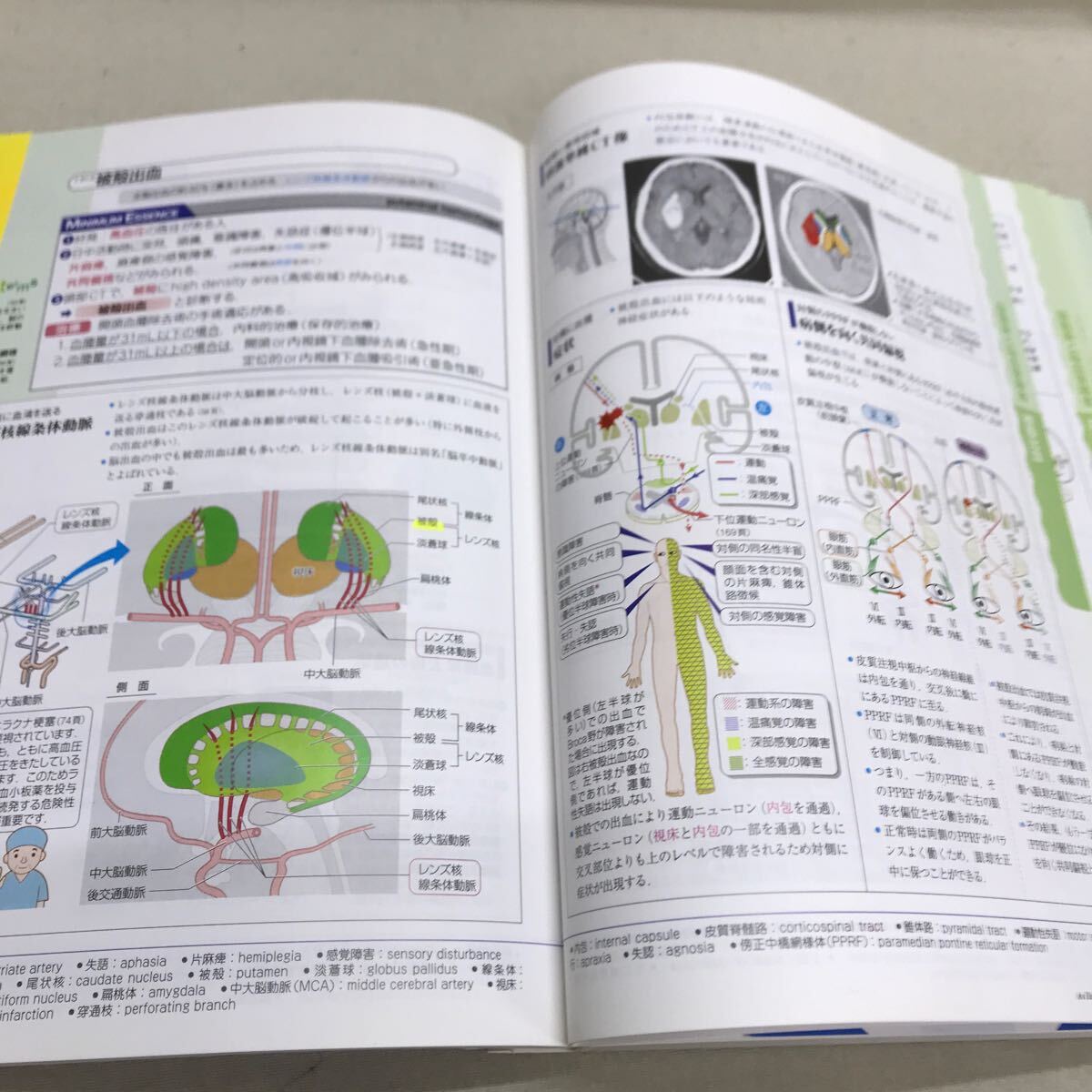 【3S35-016】送料無料 病気がみえる 2冊セット 7/脳・神経 & 12/眼科 MEDIC MEDIA_画像4