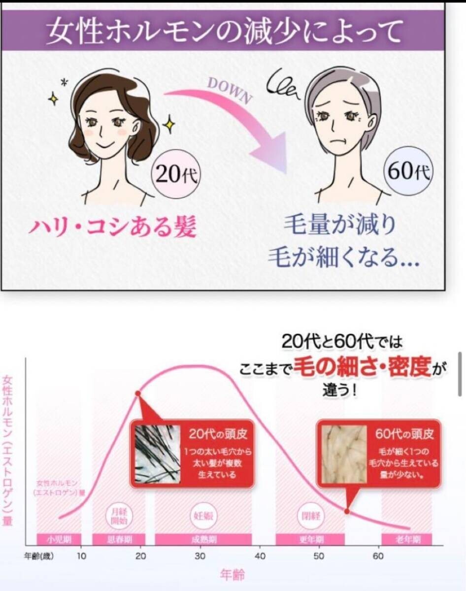 【定価12800円×2個セット】ポラリス製薬 ヘアセラム [女性用育毛剤] 120mI 医薬部外品 新品 育毛・薄毛・かゆみ・脱毛予防・毛生促進の画像10