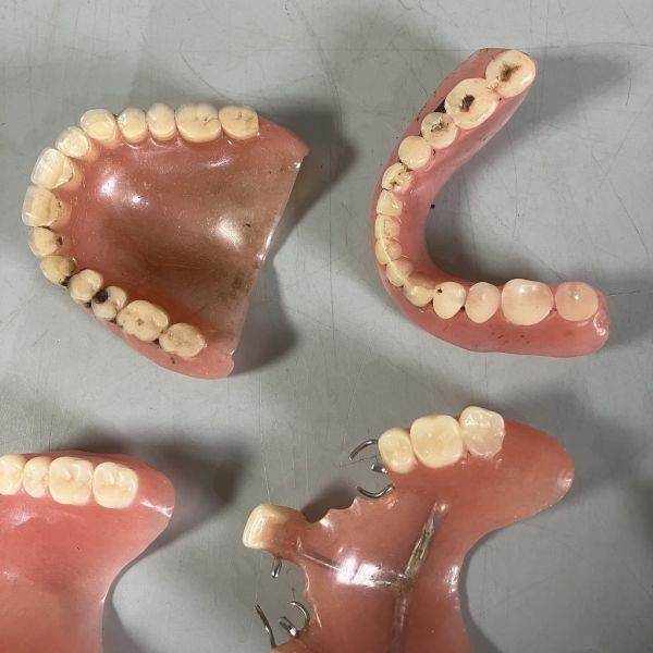 B2-550 入れ歯 歯科技工 ブリッジ ジャンク品の画像4