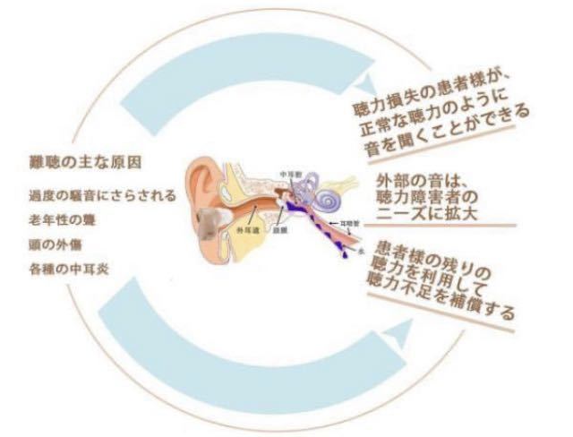 ☆最安値 補聴器 左右両用 デジタル 集音器 イヤホンキャップ 大小6種 肌色 軽量☆