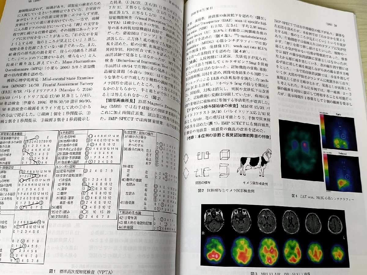 高次脳機能研究 2020.6 日本高次脳機能障害学会誌/再帰性発話と認知症/大脳機能の左右差から解く認知症の症候学/医療/医学/B3229230_画像3