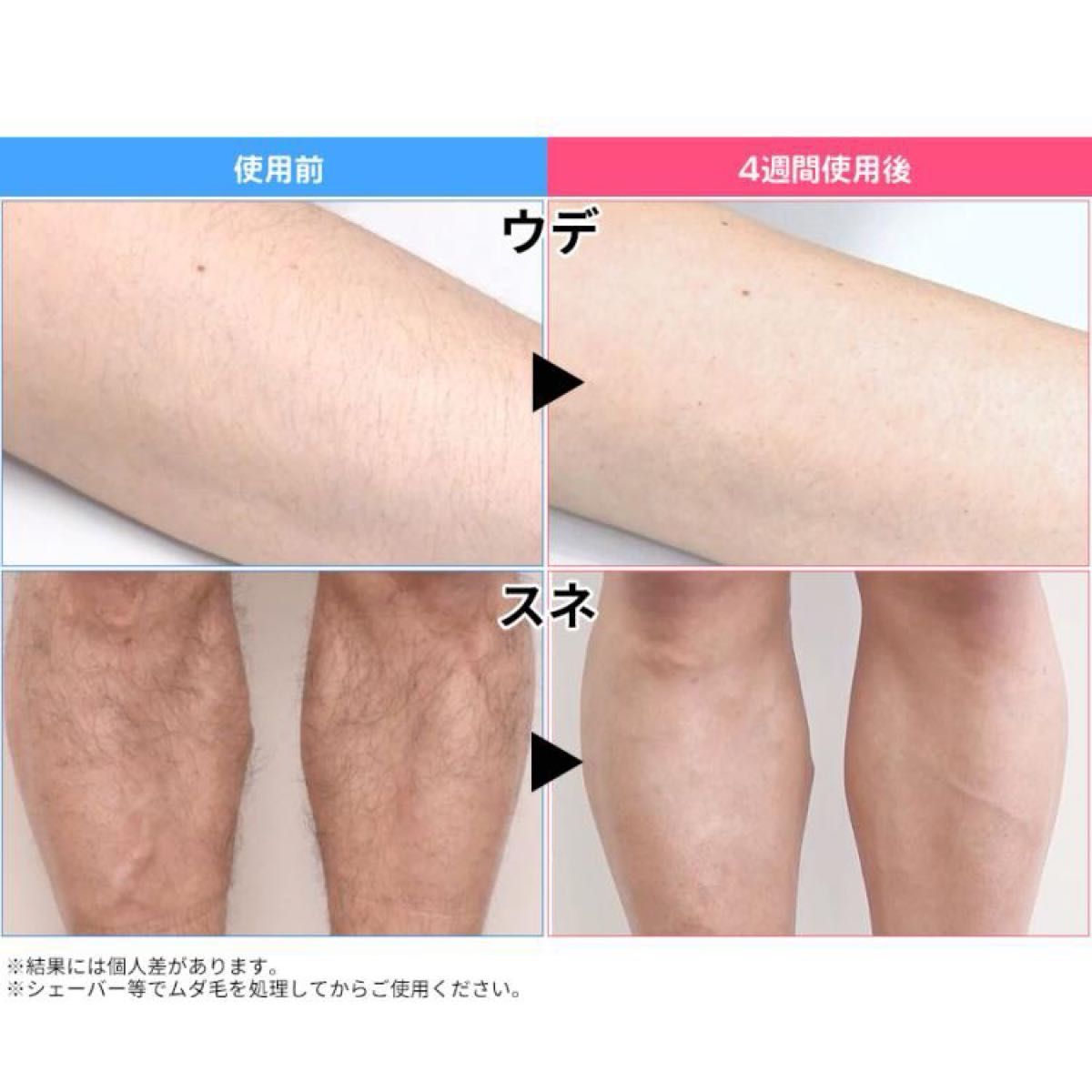 新品・未使用 未開封 【YA-MAN ヤーマン】レイボーテ ヴィーナス 新品・未使用 未開封 【YA-MAN ヤーマン】レイボーテ ヴィーナス