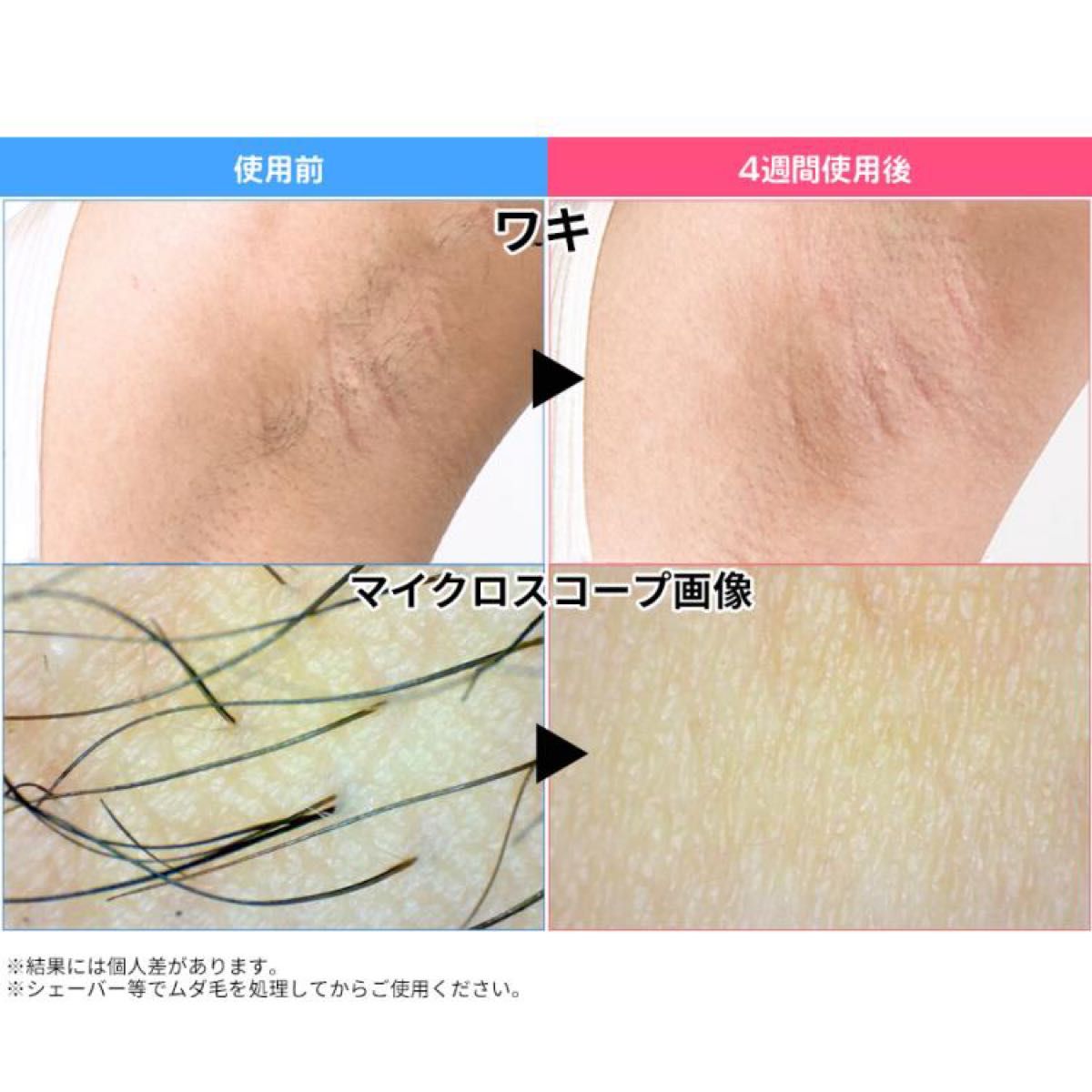 新品・未使用 未開封 【YA-MAN ヤーマン】レイボーテ ヴィーナス 新品・未使用 未開封 【YA-MAN ヤーマン】レイボーテ ヴィーナス