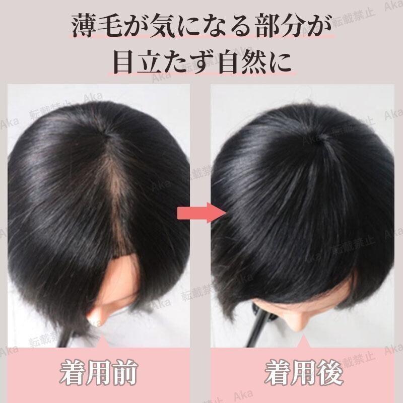 ヘアピース 黒 ブラック 部分 ウィッグ 頭頂部 薄毛 円形脱毛症 つむじ 生え際 人毛100％ 白髪隠し 円形 自然 ダブルクリップ ワンタッチ_画像3