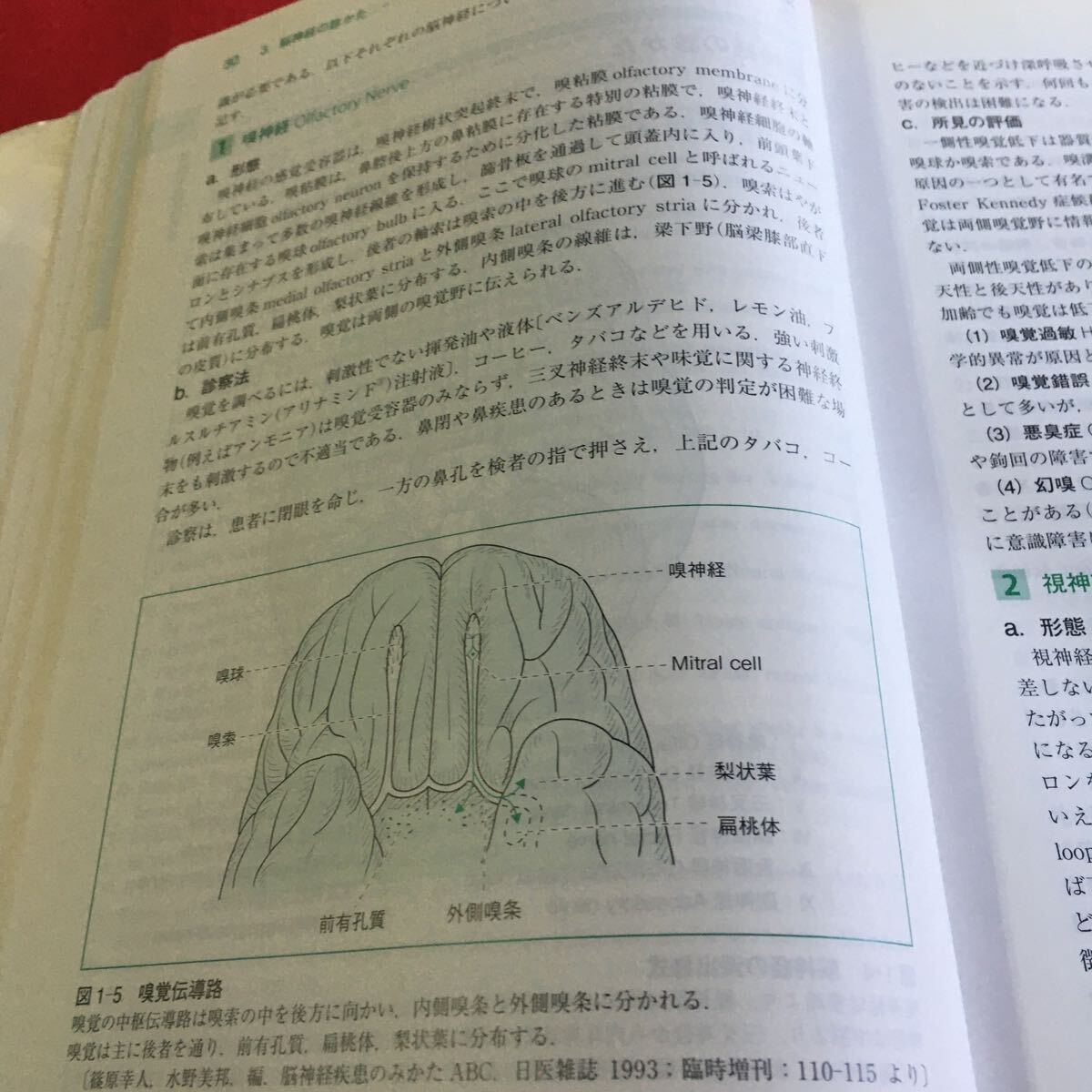 p-013 神経内科ハンドブック 鑑別診断と治療 第4版 医学書院※10_画像4