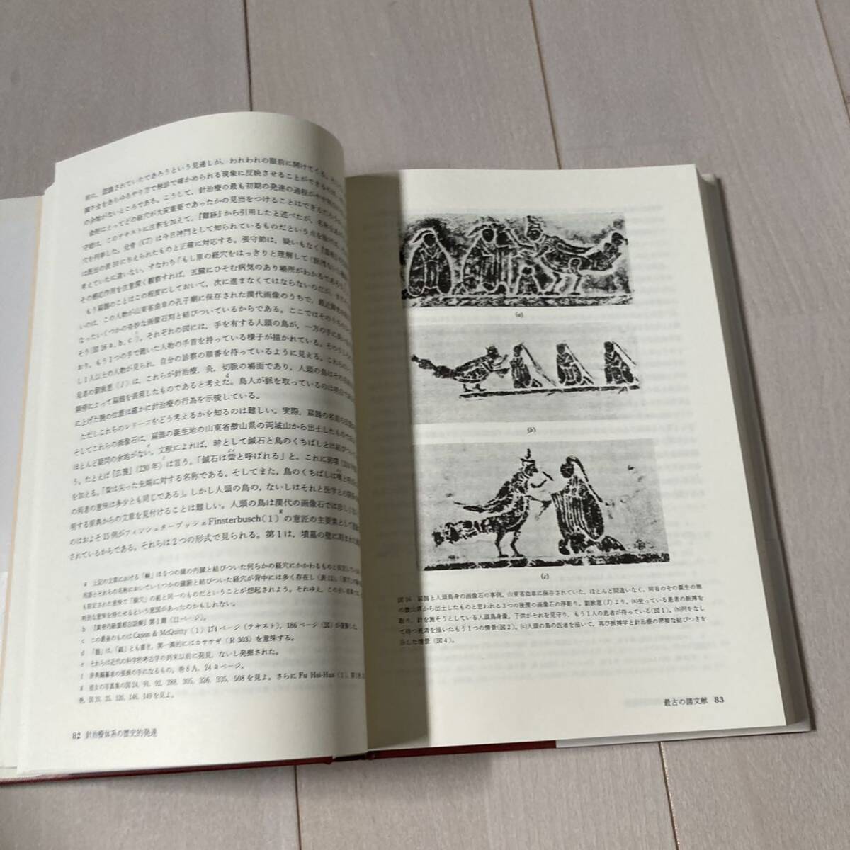 J 1989年発行 「中国のランセット-針灸の歴史と理論」_画像6