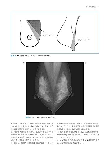 マンモグラフィガイドライン 第4版_画像3