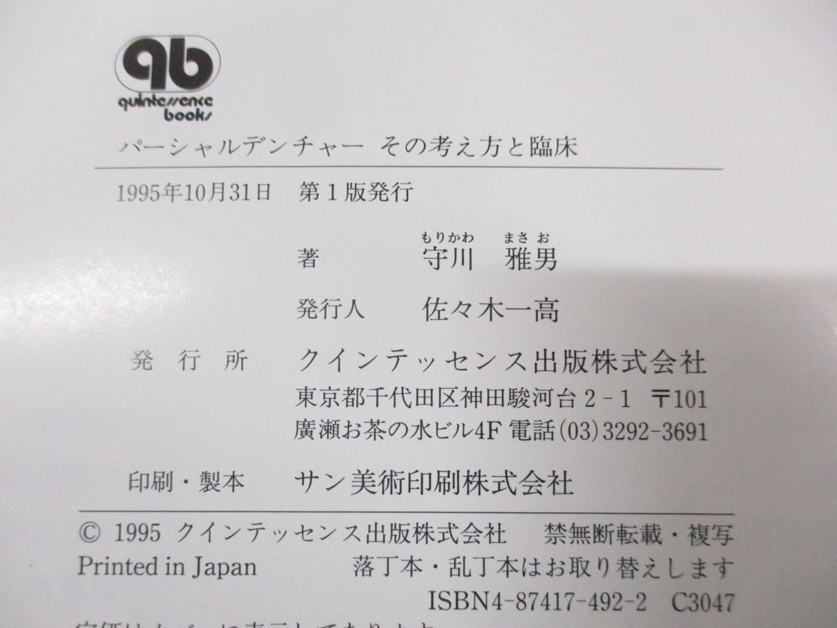 ▲01)【同梱不可】パーシャルデンチャー その考え方と臨床/守川雅男/クインテッセンス出版/1995年発行/A_画像4