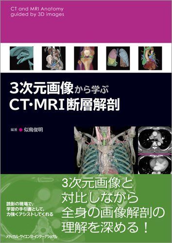[A11512535]3次元画像から学ぶCT・MRI断層解剖_画像1