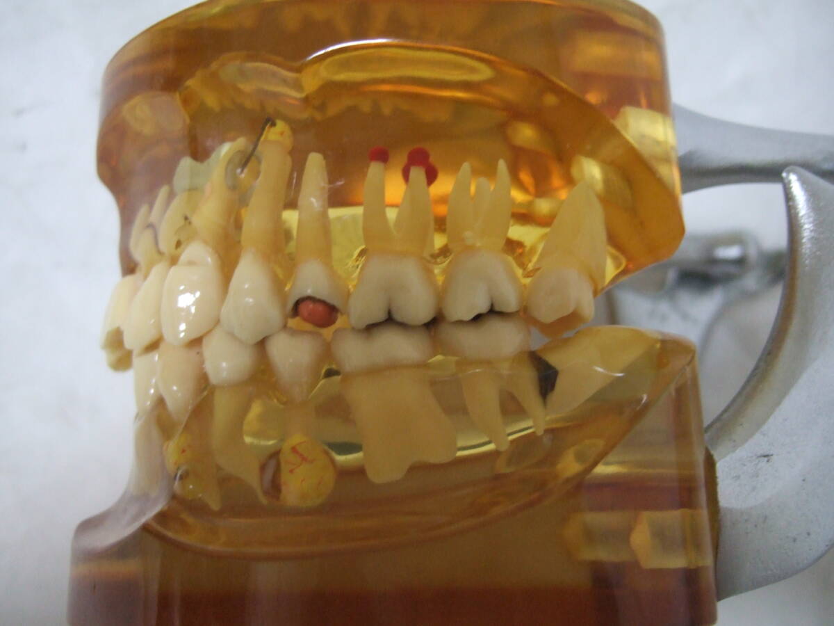 スケルトン 透明 顎 歯 歯科 疾患模型 100M_画像3