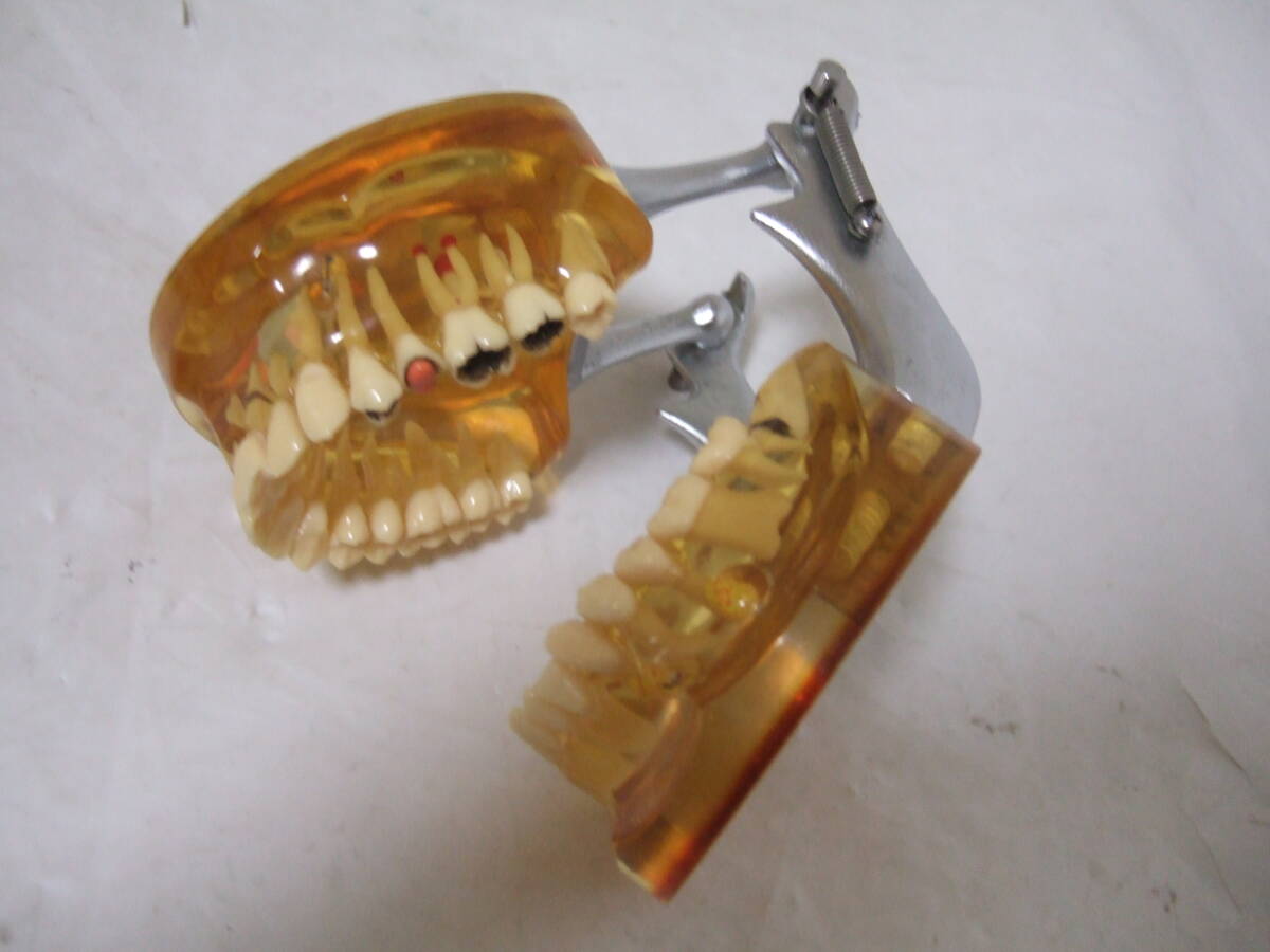 スケルトン 透明 顎 歯 歯科 疾患模型 100M_画像4