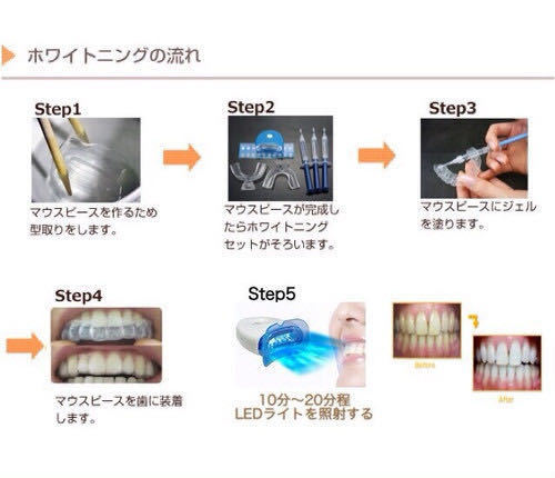 【Dental】米国製 ホームホワイトニング 6本 セット/オパール/オーラルケア/ジェル/デンタルケア/エッセンス/歯磨き 粉/剤/歯科/LEDライトの画像3