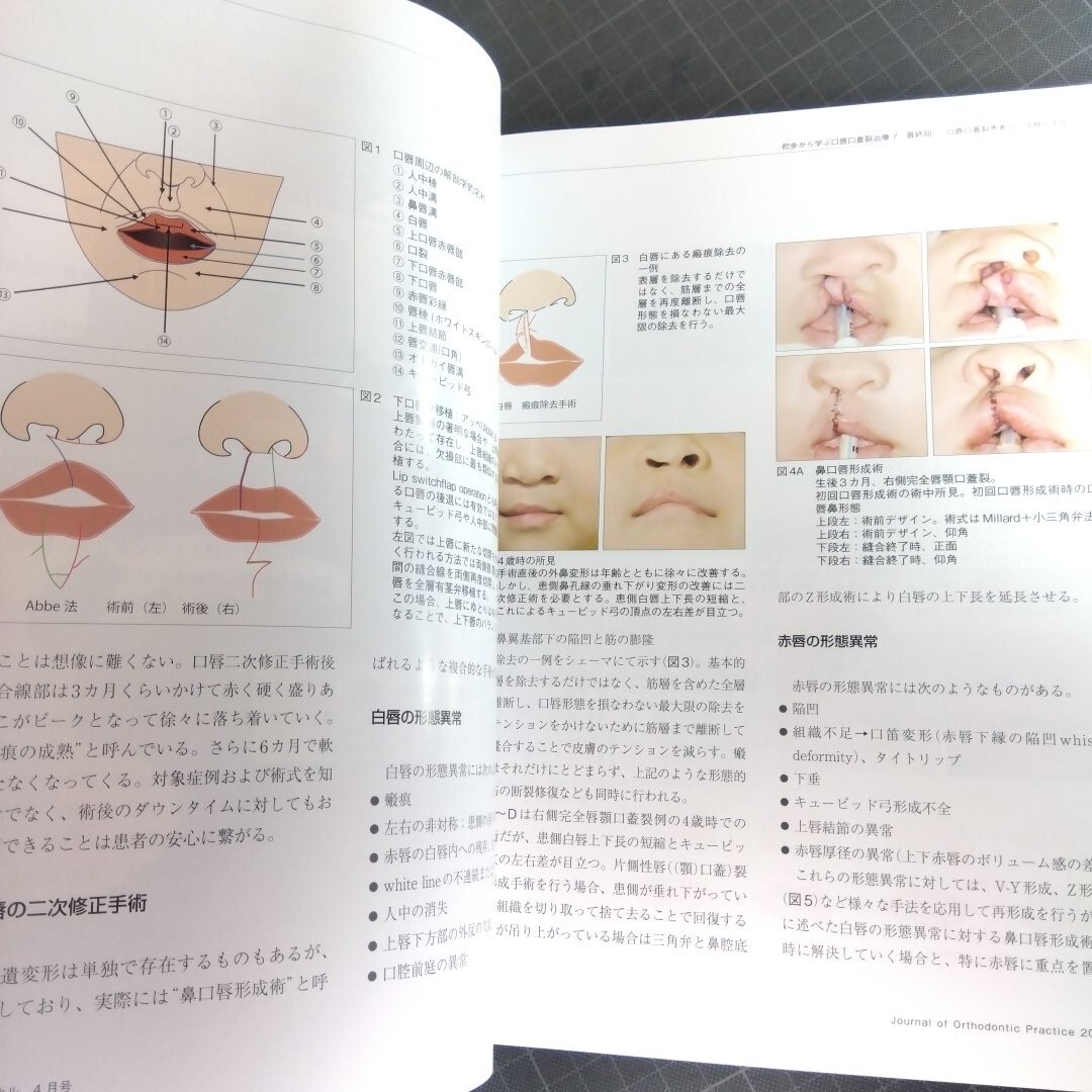 Jop 矯正臨床ジャーナル　2024年4月号　口唇裂・口蓋裂患者に対する一貫治療の流れ_画像6