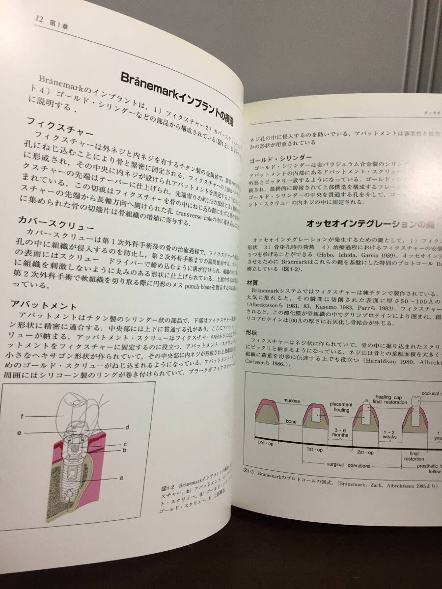 歯科学　書籍　イミディエイトロードインプラント: 21世紀の審美インプラントシステム　A52405_画像5