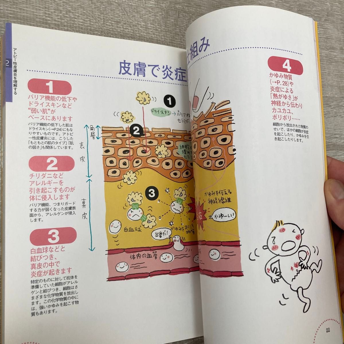 赤ちゃんと子どものアトピー＆アレルギーＢＯＯＫ （主婦の友ベストＢＯＯＫＳ） 永倉俊和／監修　主婦の友社／編