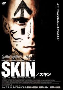 SKIN スキン レンタル落ち 中古 DVD ケース無_画像1