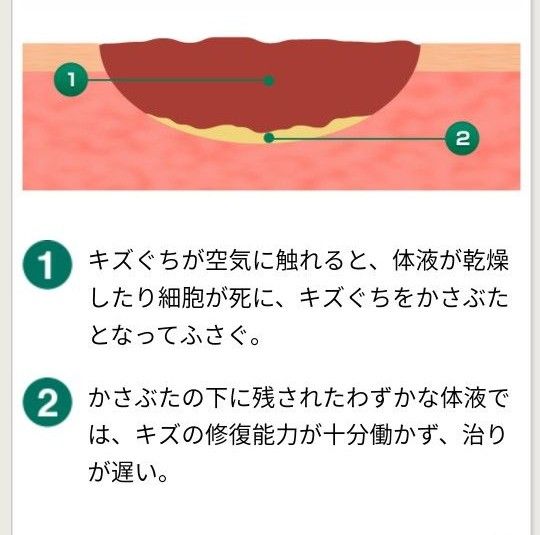 ケアリーブ 治す力  Mサイズ（12枚入り）