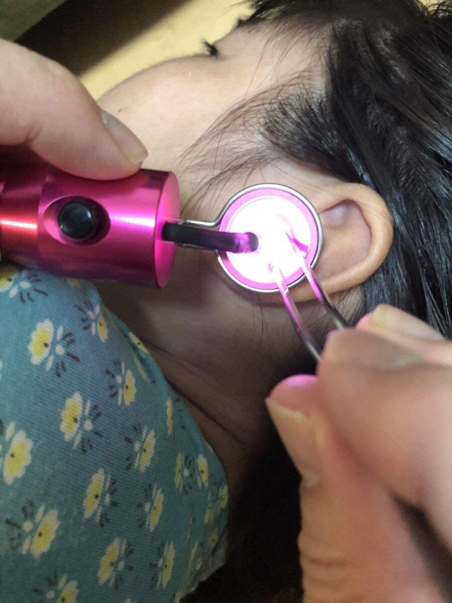 耳穴掃除セット 耳鏡 LEDライト付き 先端細ピンセット付き 2点セット / 医療用ライト 耳掃除器具 子供・大人兼用 (ピンク)_画像4