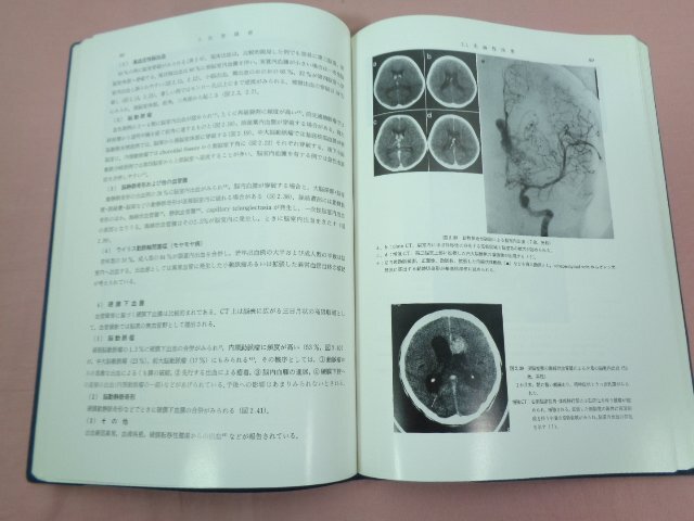 ★初版 『 救急のための頭部・脳疾患の放射線診断 』 中村紀夫 久留裕/編 朝倉書店_画像2