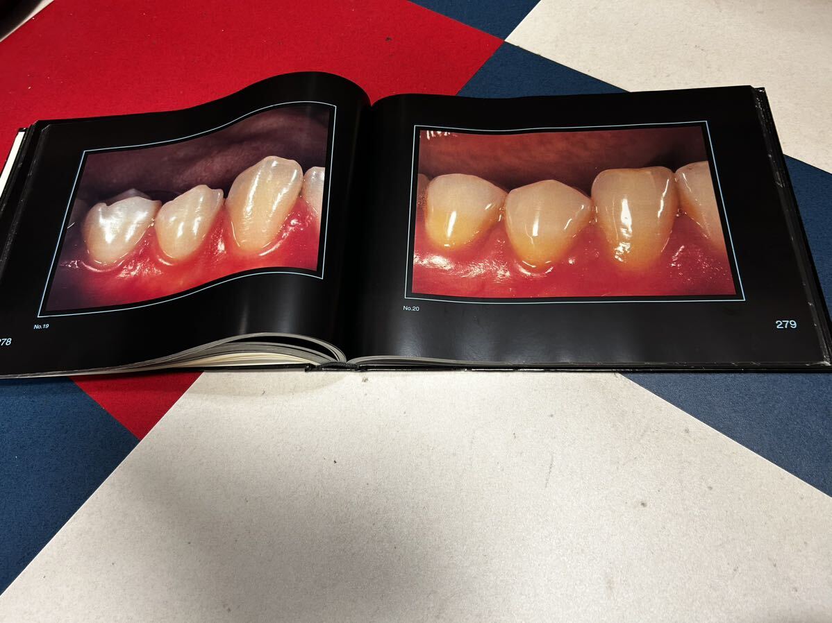 歯科技工ANALYSIS (アナリシス) 歯写真集世界で在庫無し_画像8