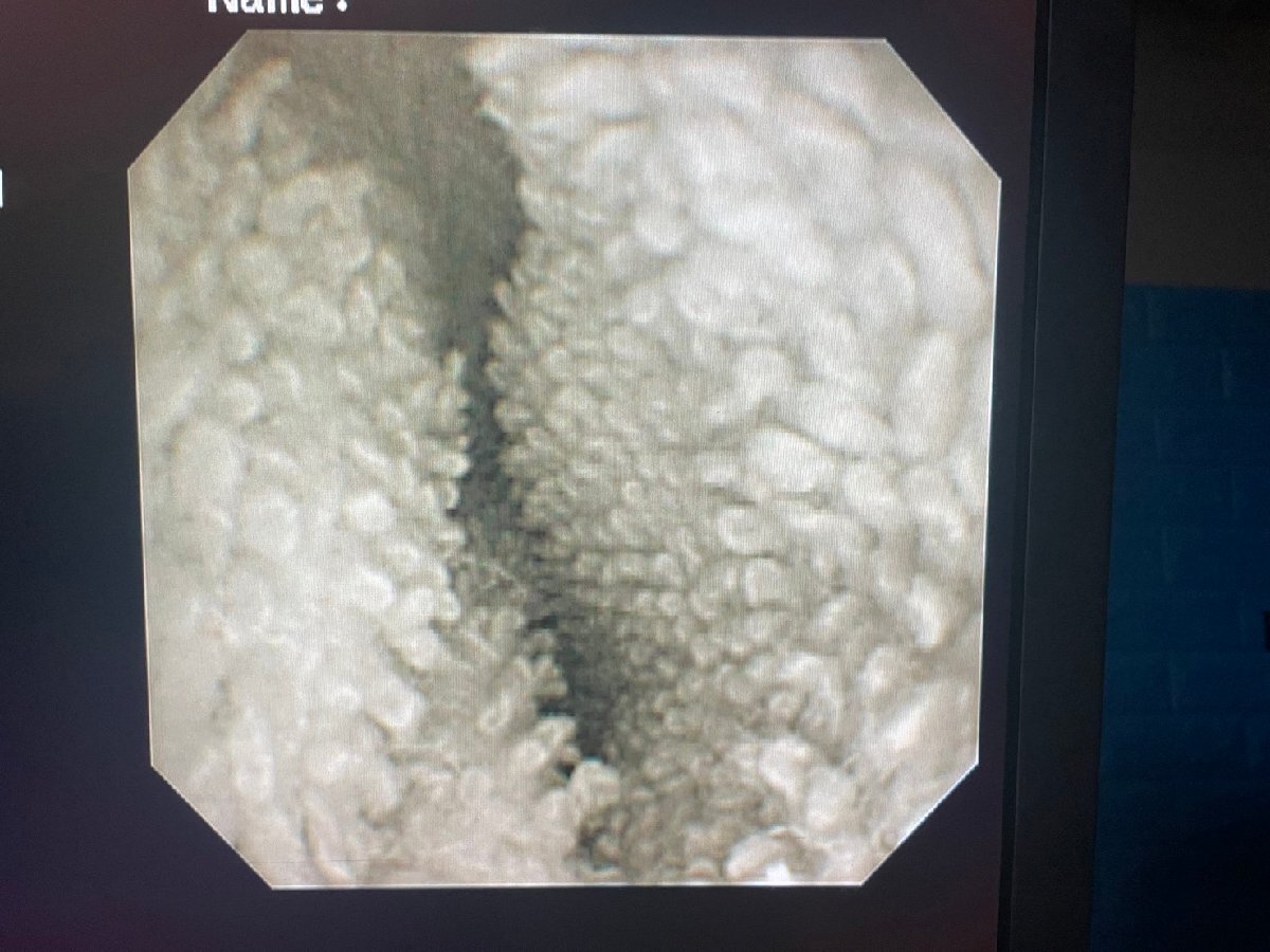 OLYMPUS GIF-XP260N ビデオ軟性胃十二指腸鏡 EVIS LUCERA 上部消化管汎用ビデオスコープ オリンパス_画像6