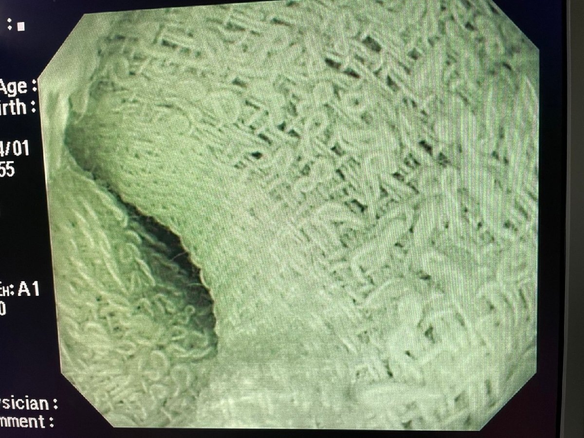 OLYMPUS GIF-H260Z　ビデオ軟性胃十二指腸鏡　EVIS LUCERA　上部消化管汎用ビデオスコープ　GIF TYPE H260Z 内視鏡 オリンパス_画像6