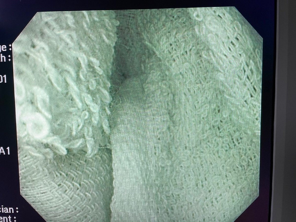 OLYMPUS GIF-H260Z　ビデオ軟性胃十二指腸鏡　EVIS LUCERA　上部消化管汎用ビデオスコープ　GIF TYPE H260Z 内視鏡 オリンパス_画像7