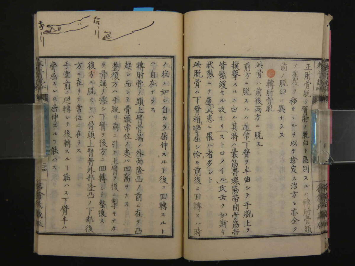 整骨説略　名倉知文訳述　明治７年　１冊　整形　和本　古文書　①_画像5